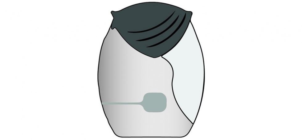 Ellipta inhaler